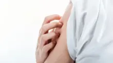 Miért viszket a bőr és hogyan enyhíthető a kellemetlen érzés?