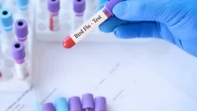 Ausztráliában az első emlősnél is kimutatták a H5N1 madárinfluenzát