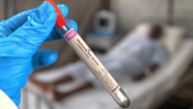 Gyorstesztekkel segíti az Európai Unió a kongói ebolajárvány elleni védekezést