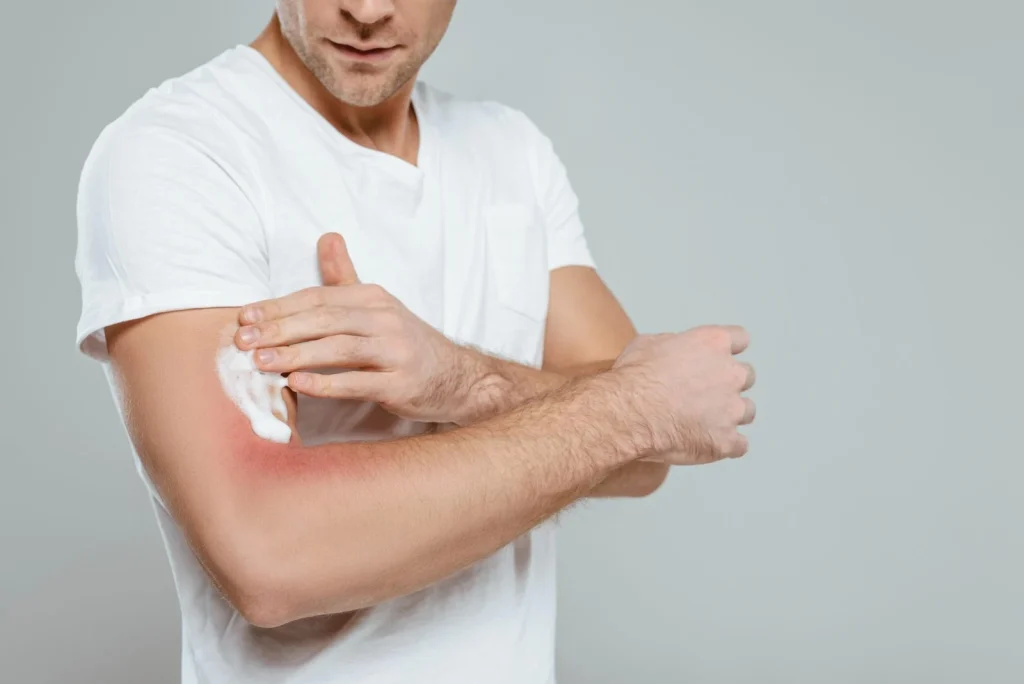 Így hat a tartós stressz a bőrünkre: szakértői tanácsok a regenerációhoz