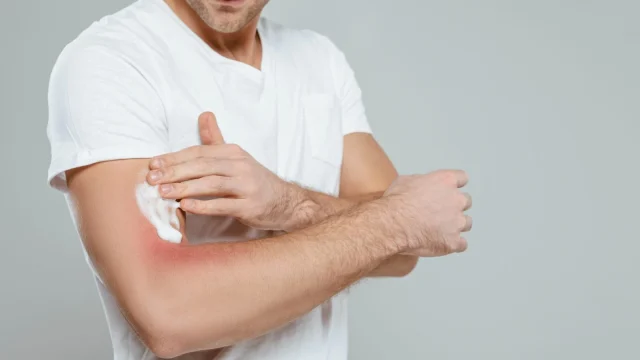 Így hat a tartós stressz a bőrünkre: szakértői tanácsok a regenerációhoz
