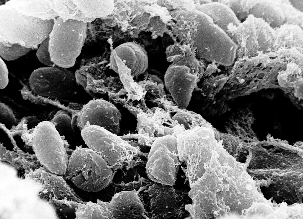 Pestisgyanús eset Oroszországban: miért veszélyes a tüdőpestis?